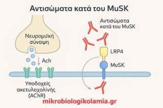 anti-MuSK τι είναι