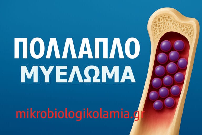 Πολλαπλό Μυέλωμα – Οδηγός: διάγνωση SLiM-CRAB, θεραπεία, ASCT, CAR-T