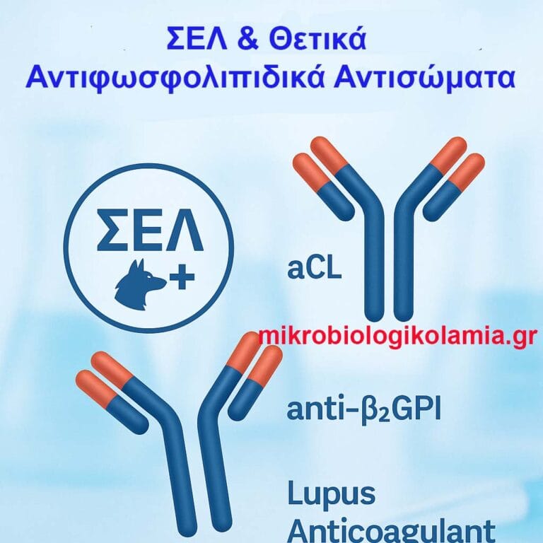 ΣΕΛ & Θετικά Αντιφωσφολιπιδικά Αντισώματα