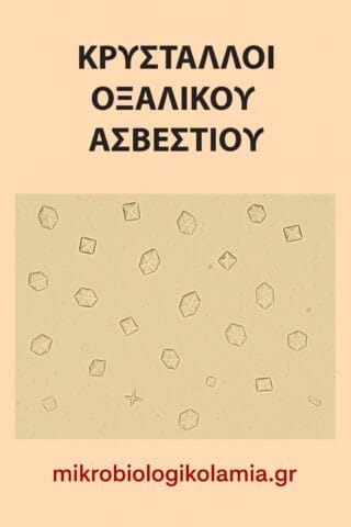 Κρύσταλλοι οξαλικού ασβεστίου στα ούρα σε μικροσκοπική εξέταση
