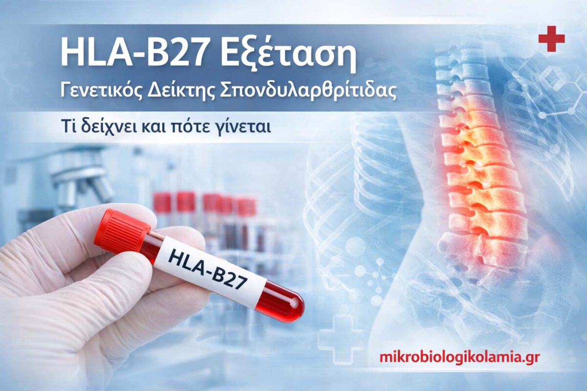 hla-b27-exetasi-mikrobiologikolamia-1200x628-1-1200x800.jpg