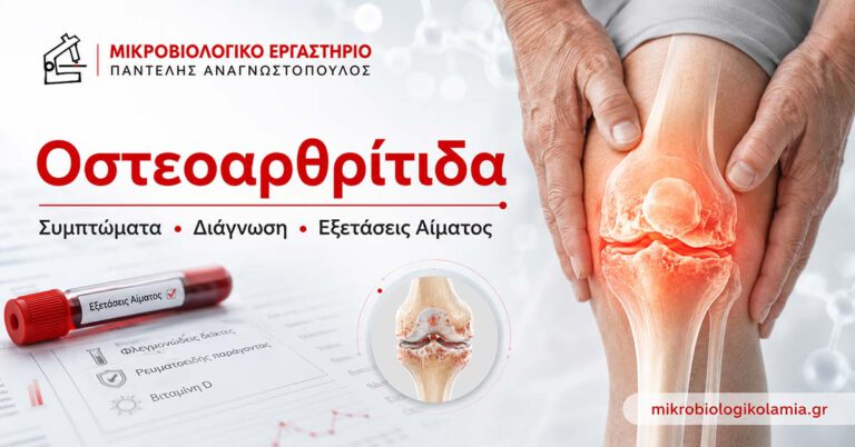 Οστεοαρθρίτιδα: Συμπτώματα & Εξετάσεις Αίματος 1 Οστεοαρθρίτιδα: συμπτώματα, διάγνωση και εξετάσεις αίματος
