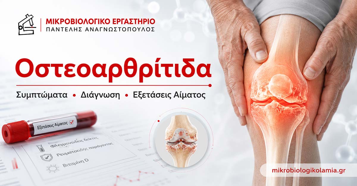 Οστεοαρθρίτιδα: Συμπτώματα & Εξετάσεις Αίματος 1 Οστεοαρθρίτιδα: συμπτώματα, διάγνωση και εξετάσεις αίματος