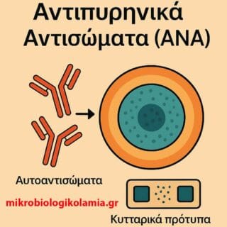 Αντιπυρηνικά αντισώματα (ANA) – σχηματική απεικόνιση αυτοαντισωμάτων που στοχεύουν τον πυρήνα κυττάρου με κυτταρικά πρότυπα ανοσοφθορισμού, διαγνωστική εξέταση για αυτοάνοσα νοσήματα. |mikrobiologikolamia.gr