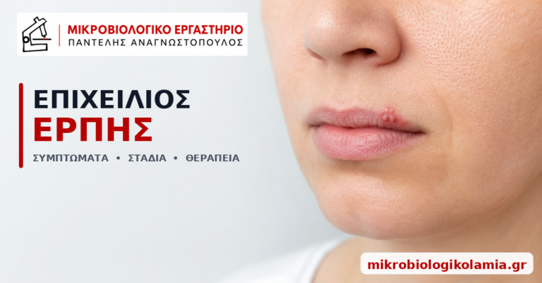 Επιχείλιος έρπης στα χείλη – συμπτώματα, στάδια και θεραπεία