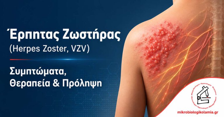 Έρπης Ζωστήρας (VZV): Συμπτώματα, Θεραπεία, Εμβόλιο & Πόνος 1 Έρπητας ζωστήρας Herpes Zoster VZV με εξάνθημα, νευρικό πόνο, συμπτώματα, θεραπεία και πρόληψη