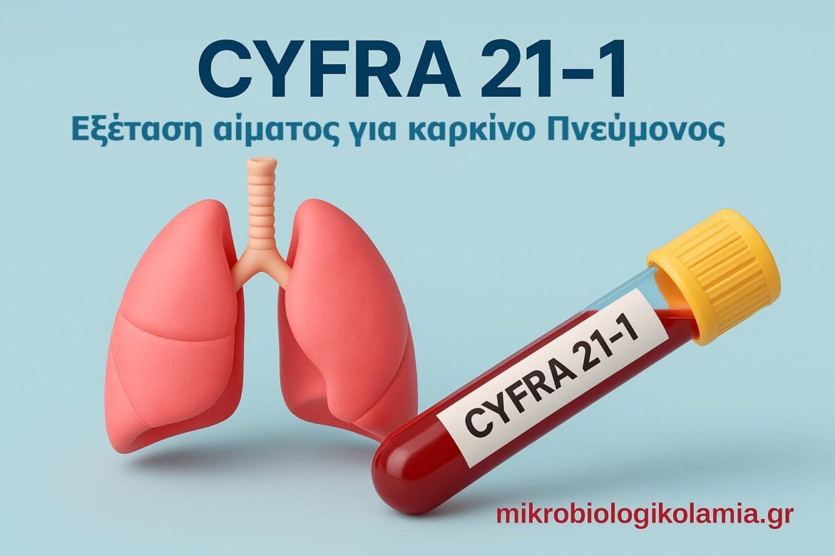 CYFRA-21-Οδηγός-για-Ασθενείς-1-1200x800.jpg