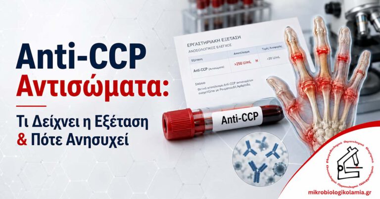 Anti-CCP Αντισώματα: Τι Δείχνει η Εξέταση & Πότε Ανησυχεί 5 Anti-CCP αντισώματα εξέταση αίματος με δείγμα αίματος, αρθρώσεις χεριού και ρευματοειδή αρθρίτιδα