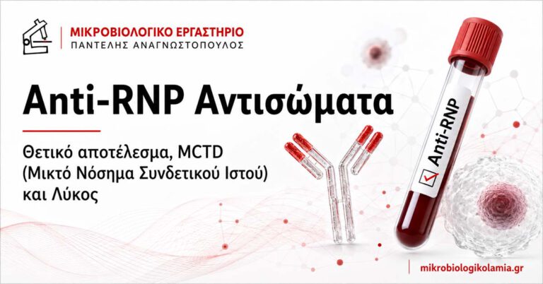 Anti-RNP αντισώματα – θετικό αποτέλεσμα, MCTD (μικτό νόσημα συνδετικού ιστού) και λύκος
