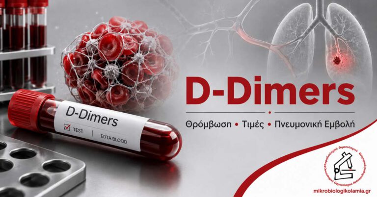 D-Dimers: Τι Δείχνει η Εξέταση, Τιμές, Υψηλό Αποτέλεσμα & Θρόμβωση 1 D-Dimers εξέταση αίματος για θρόμβωση, τιμές και πνευμονική εμβολή
