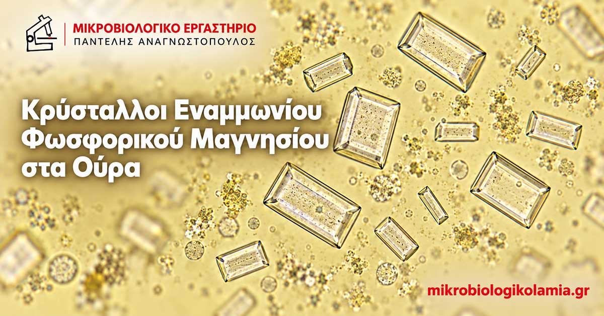 Κρύσταλλοι Εναμμωνίου Φωσφορικού Μαγνησίου στα Ούρα