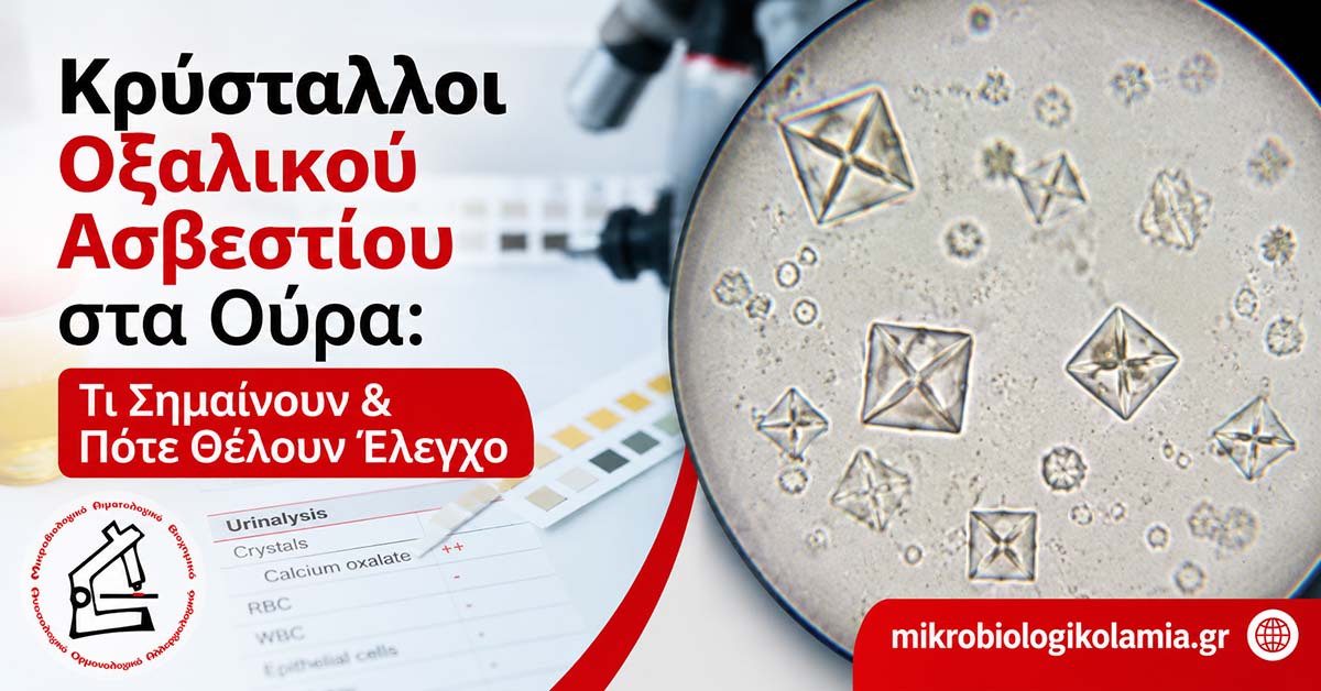 Κρύσταλλοι Οξαλικού Ασβεστίου στα Ούρα: Τι Σημαίνουν & Πότε Θέλουν Έλεγχο