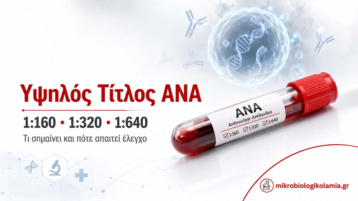 Υψηλός τίτλος ANA (1:160–1:640): ερμηνεία & τι σημαίνει στην πράξη 1 Υψηλός τίτλος ANA 1:160 1:320 1:640 σε εξέταση αίματος για αντιπυρηνικά αντισώματα
