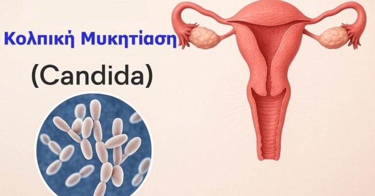 Κολπική Μυκητίαση (Candida) – Συμπτώματα, Θεραπεία & Πρόληψη | Μικροβιολογικό Λαμία