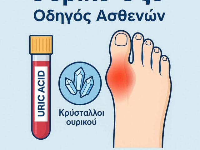 Ουρικό Οξύ Ουρική Αρθρίτιδα Διατροφή Πλήρης Οδηγός