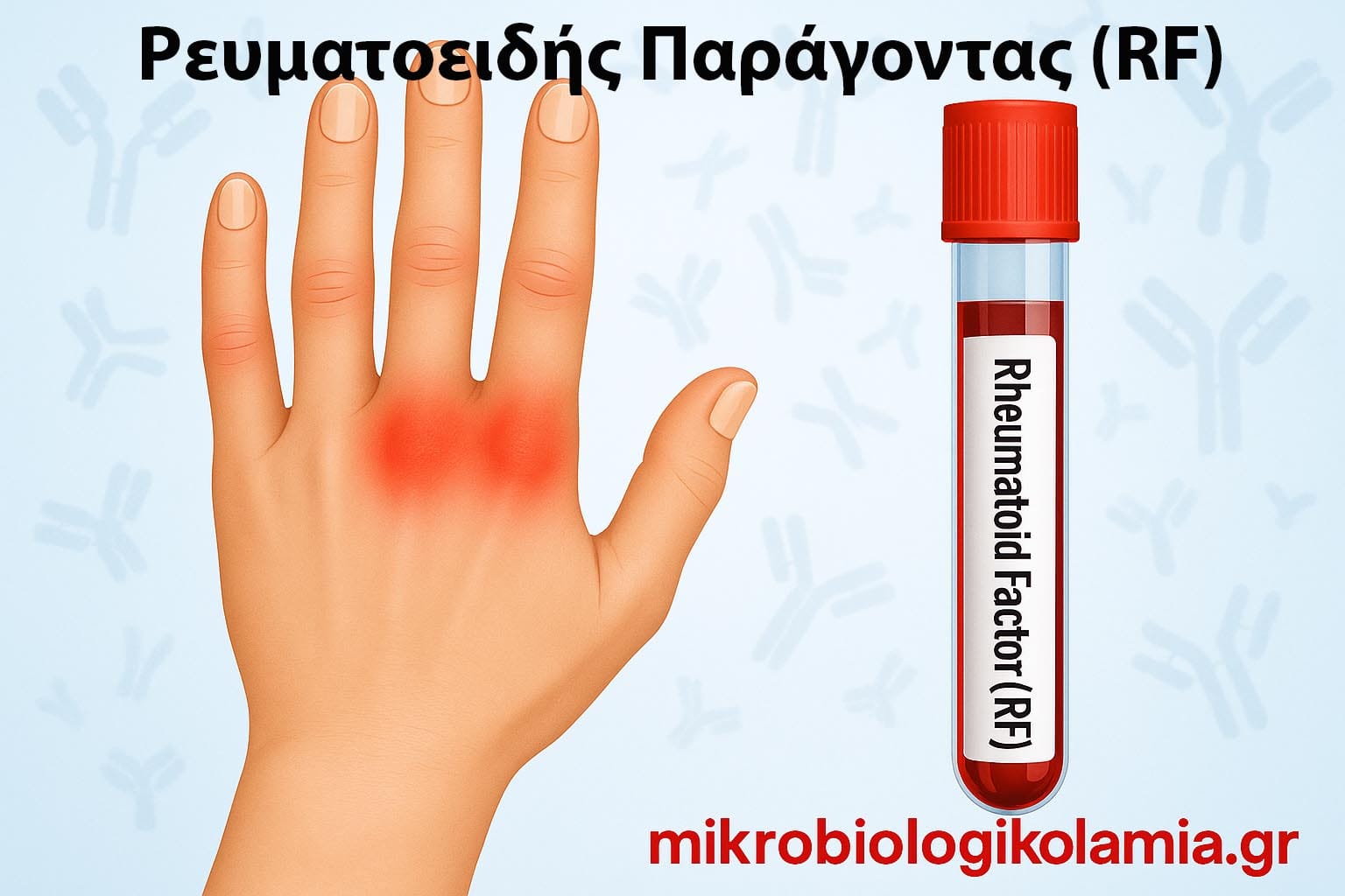 Ρευματοειδής-Παράγοντας-RF.jpg