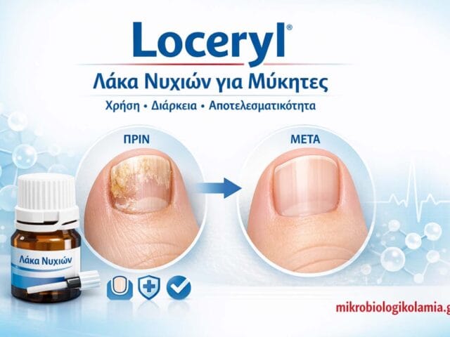 loceryl laka nychion mykites odigos mikrobiologikolamia 1200x628 1