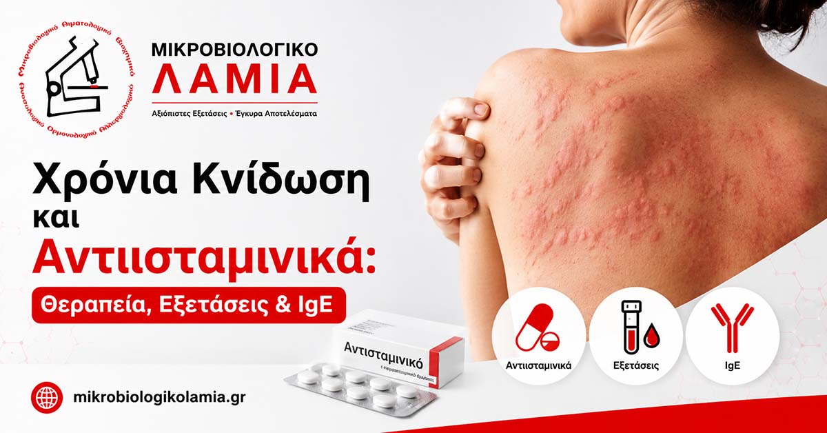 Χρόνια Κνίδωση και Αντιισταμινικά: Θεραπεία, Εξετάσεις & IgE