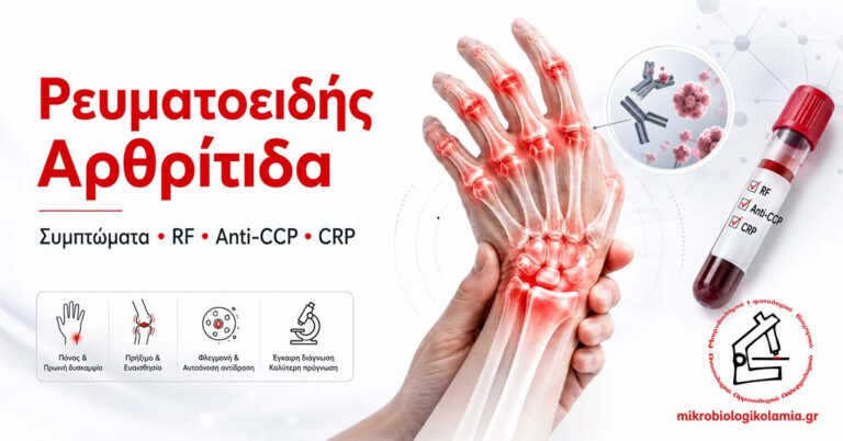 Ρευματοειδής Αρθρίτιδα: Συμπτώματα, RF & Anti-CCP