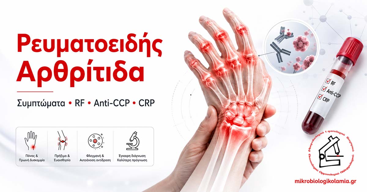Ρευματοειδής αρθρίτιδα με φλεγμονή στις αρθρώσεις των χεριών και εξετάσεις RF, Anti-CCP και CRP