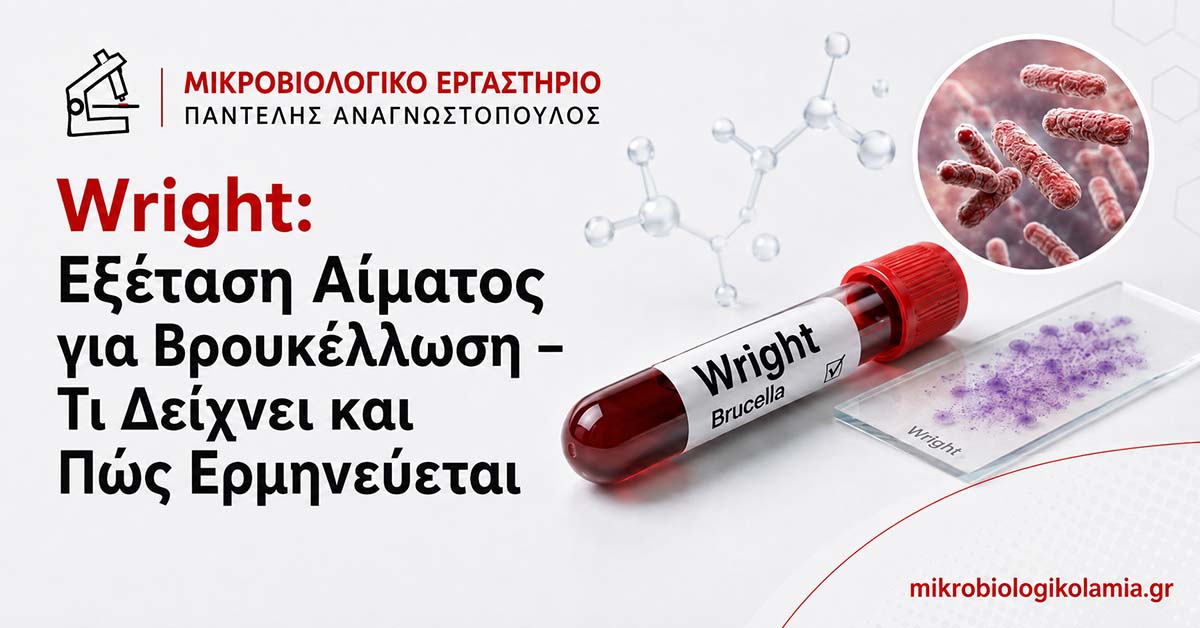 Wright Εξέταση Αίματος: Τι Δείχνει για τη Βρουκέλλωση 1 Wright εξέταση αίματος για βρουκέλλωση με σωληνάριο αίματος, απεικόνιση Brucella και εργαστηριακό πλακίδιο.