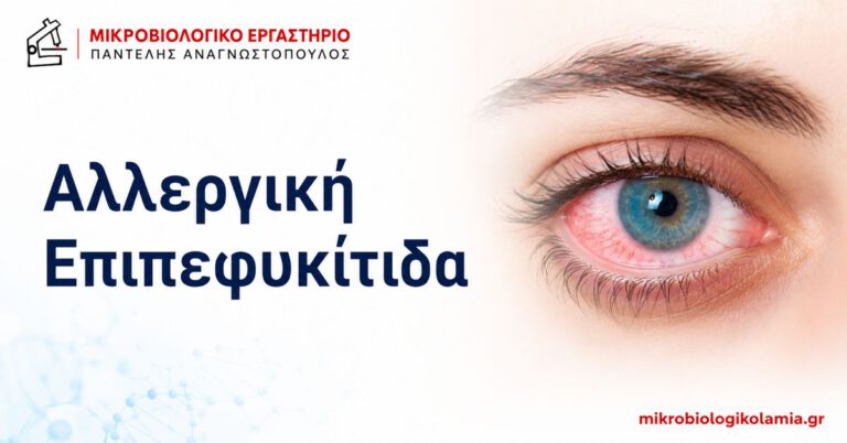 Αλλεργική Επιπεφυκίτιδα: Συμπτώματα, Κολλύρια & IgE 4 Αλλεργική επιπεφυκίτιδα – ερεθισμένο κόκκινο μάτι με λογότυπο Μικροβιολογικού Εργαστηρίου Λαμίας