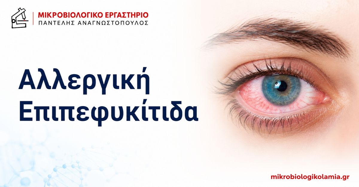 Αλλεργική Επιπεφυκίτιδα: Συμπτώματα, Κολλύρια & IgE