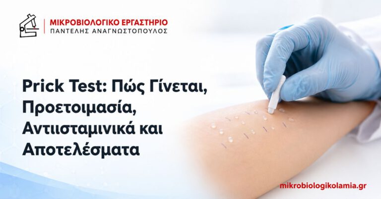 Prick Test: Πώς Γίνεται, Προετοιμασία, Αντιισταμινικά και Αποτελέσματα 2 Prick test αλλεργίας στο αντιβράχιο – προετοιμασία, αντιισταμινικά και αποτελέσματα