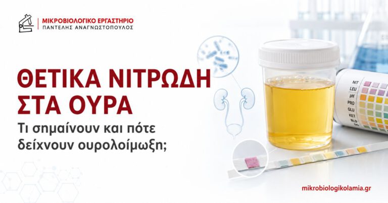 Θετικά Νιτρώδη στα Ούρα: Τι Σημαίνουν; 2 Θετικά νιτρώδη στα ούρα, γενική ούρων και έλεγχος για ουρολοίμωξη