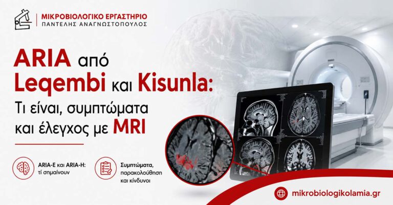 ARIA από Leqembi και Kisunla 4 ARIA από Leqembi και Kisunla – συμπτώματα και έλεγχος με MRI εγκεφάλου
