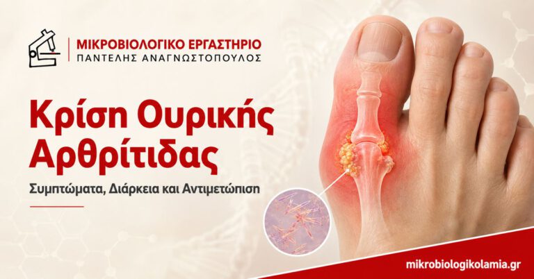 Κρίση ουρικής αρθρίτιδας στο μεγάλο δάκτυλο – συμπτώματα, διάρκεια και αντιμετώπιση