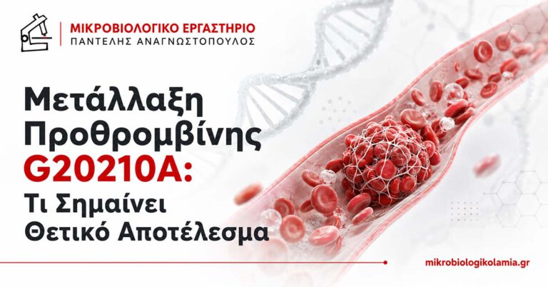 Μετάλλαξη Προθρομβίνης G20210A: Θετικό Αποτέλεσμα 2 Μετάλλαξη προθρομβίνης G20210A και θετικό αποτέλεσμα