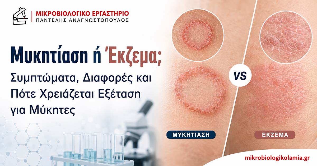 Μυκητίαση ή Έκζεμα; Πώς Ξεχωρίζουν και Εξέταση Μυκήτων